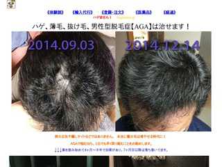 ハゲません。　男性型脱毛症AGAは、治ります。