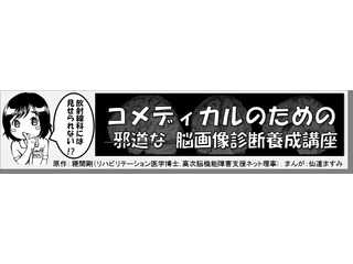 コメディカルのための（邪道な）脳画像診断養成講座